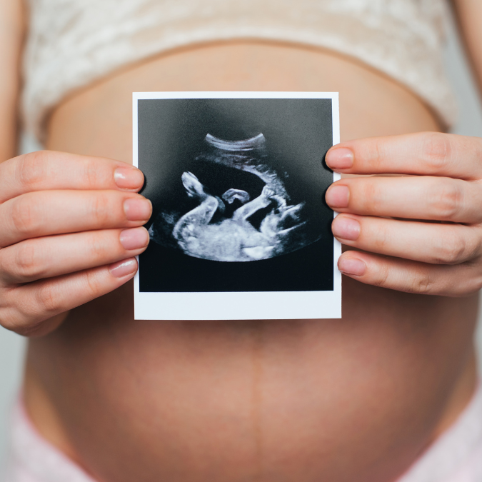 Facebook Ads - 2024-07-19T151048.451